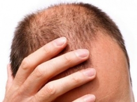 QUANTOS FIOS DE CABELO É NORMAL PERDER POR DIA?